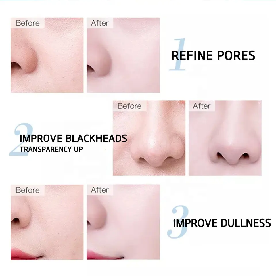 Anti-Wrinkle Pure Hyaluronic Acid Serum