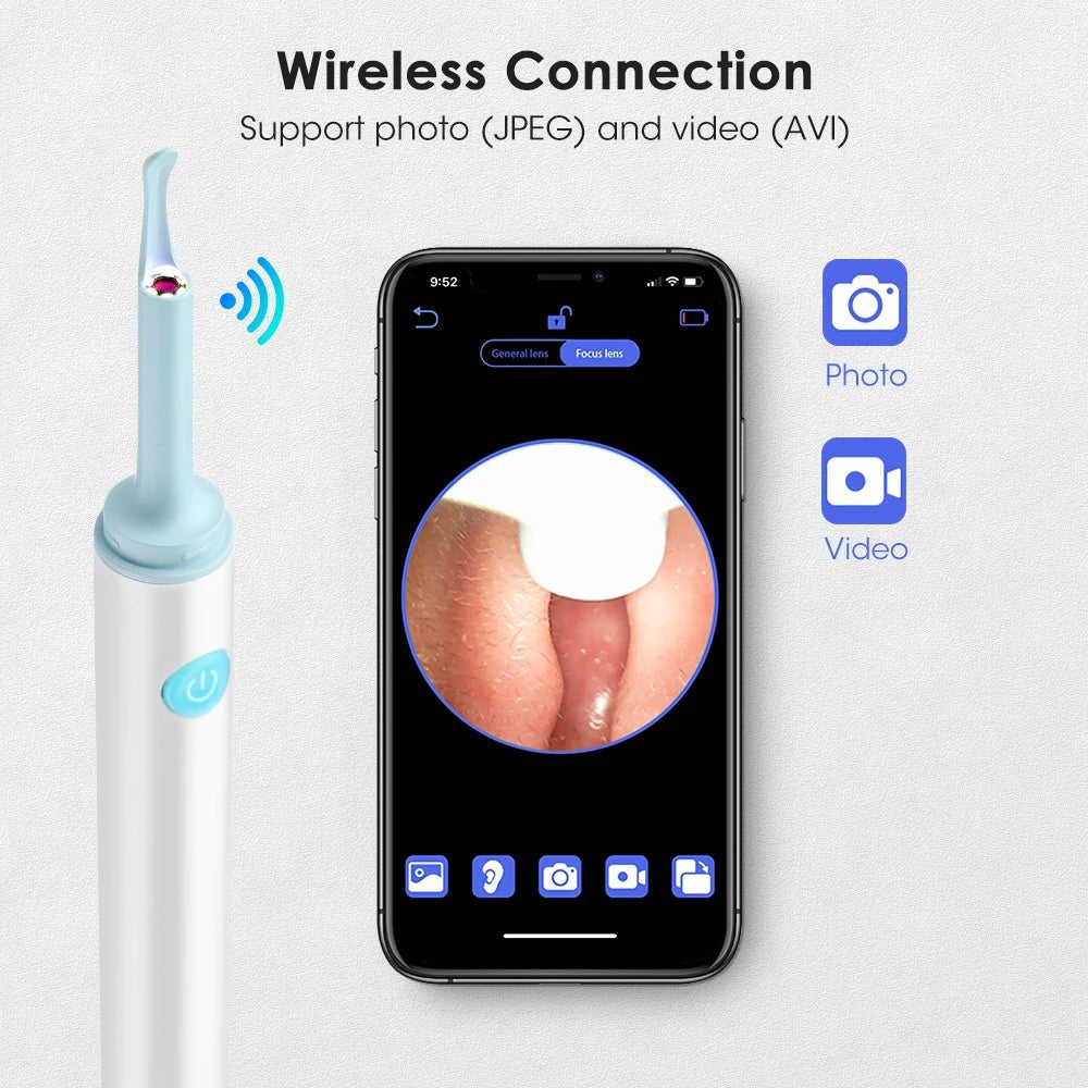 3.9mm Wireless WiFi Ear Pick Otoscope Camera Borescope Luminous Ear Wax Cleaning Teeth Oral Inspection Health Care - Alpha Omega Vitality