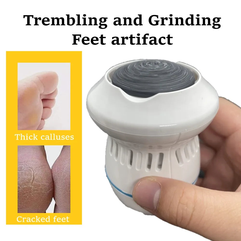 Vacuum Callus Remover